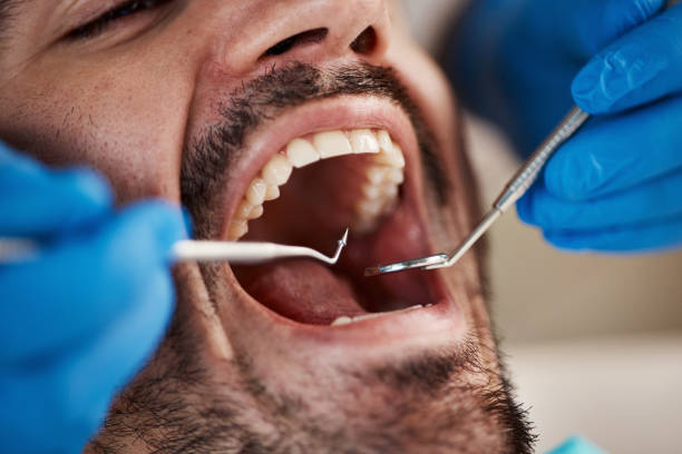 Best Dentist for Tooth Abscess  in Cumberland, KY